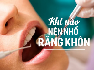 Nhổ răng khôn có nguy hiểm không? Khi nào nên nhổ răng khôn?