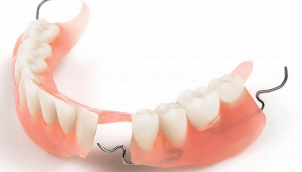 Phục hình răng tháo lắp