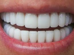 Răng chuẩn phong thủy và những ảnh hưởng