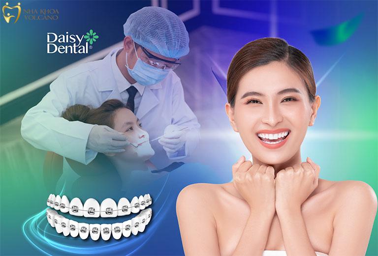 Niềng răng Bình Dương tại Nha khoa Quốc tế DAISY với đội ngũ bác sĩ tinh tế và giỏi chuyên môn Niềng răng Bình Dương tại Nha khoa Quốc tế DAISY với đội ngũ bác sĩ tinh tế và giỏi chuyên môn