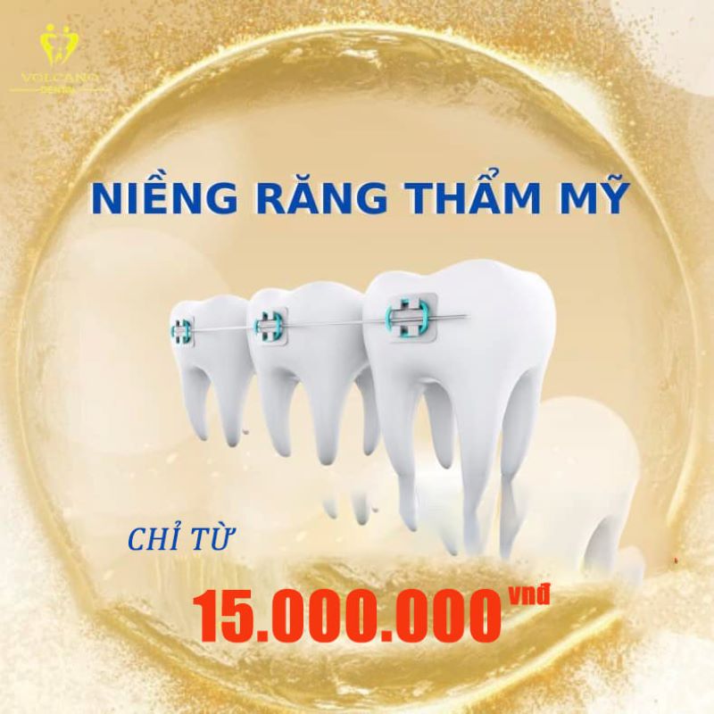 Niềng răng Nha khoa Paris Bình Dương Niềng răng thẩm mỹ