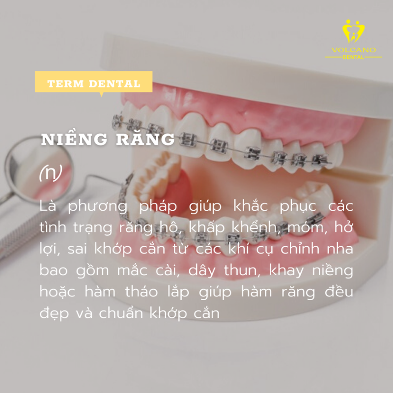 Nha khoa niềng răng cho trẻ em ở Bình Dương tốt nhất Nha khoa niềng răng cho trẻ em ở Bình Dương tốt nhất