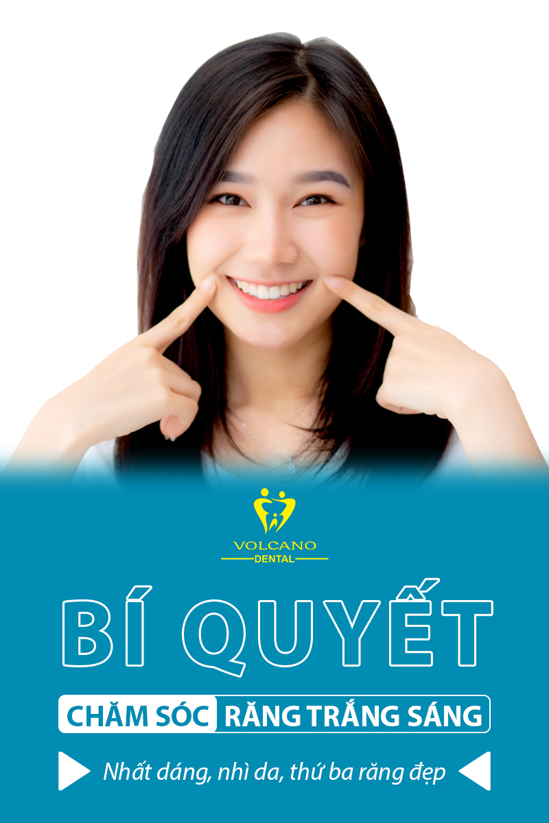 bảng giá trồng răng implant ở bình dương