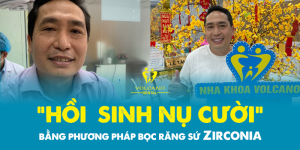 Ưu nhược điểm của phương pháp bọc răng sứ ở Bình Dương