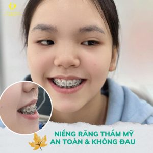 Tham khảo giá bọc răng sứ ở Bình Dương