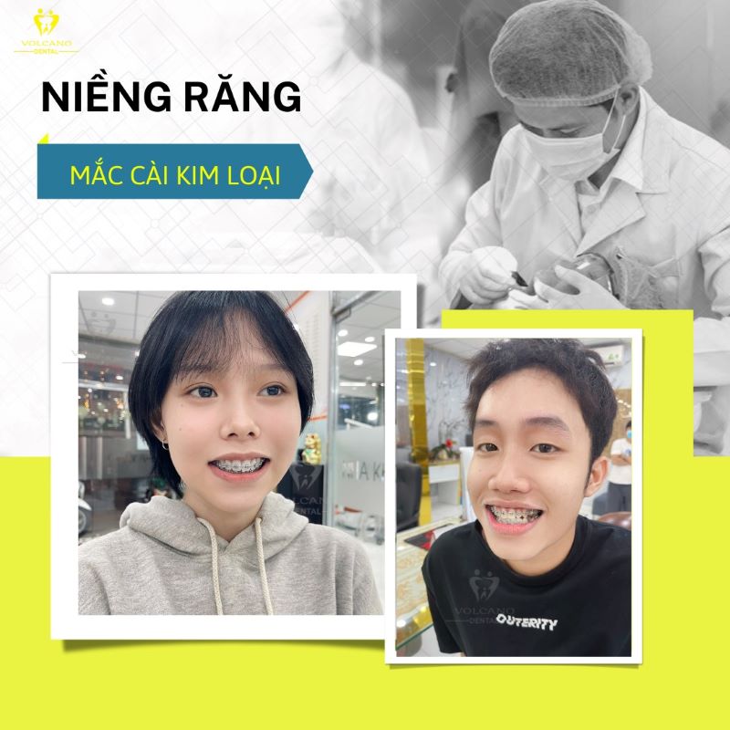 Địa chỉ nha khoa niềng răng uy tín Địa chỉ nha khoa niềng răng uy tín