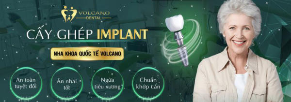 Cấy ghép Implant và bảng giá mới nhất khi trồng Răng Implant tại VOLCANO