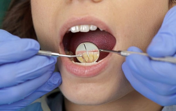 Thăm khám răng miệng Thăm khám răng miệng
