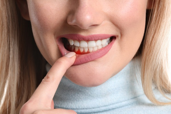 Hãy chăm sóc sức khỏe răng miệng thật tốt và bổ sung chất dinh dưỡng cho cơ thể! Hãy chăm sóc sức khỏe răng miệng thật tốt và bổ sung chất dinh dưỡng cho cơ thể!