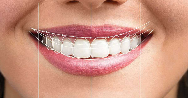 Có nhiều trường hợp sẽ được bác sĩ chỉ định cắt lợi Có nhiều trường hợp sẽ được bác sĩ chỉ định cắt lợi