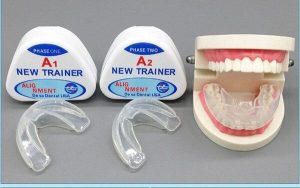 [Giải đáp thắc mắc] Niềng răng tại nhà có thực sự hiệu quả?