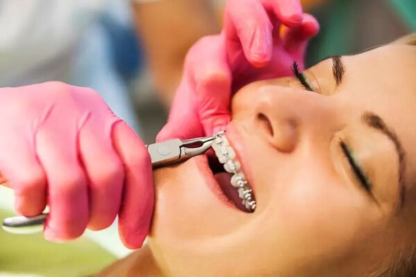 Lựa chọn nha khoa uy tín để niềng răng Lựa chọn nha khoa uy tín để niềng răng