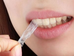 Cách sử dụng miếng dán trắng răng hiệu quả tại nhà