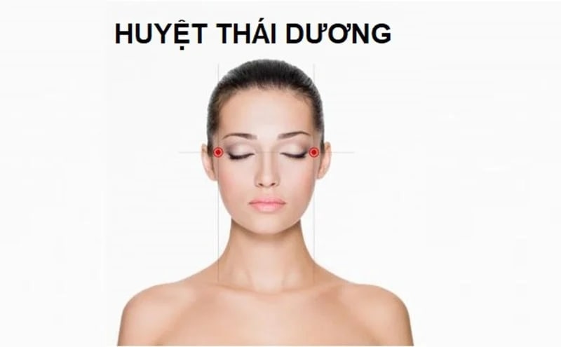 Hóp thái dương khi niềng răng có thật không? Nguyên nhân và cách khắc phực Tình trạng hóp thái dương trong quá trình niềng răng