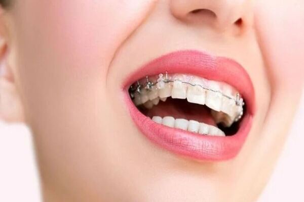 Bạn cần lưu ý đến những giải pháp can thiệp chúng tôi hướng dẫn sau đây!