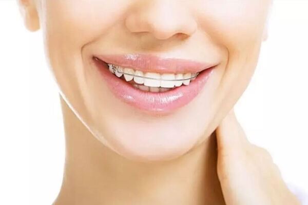 Nha khoa Đồng  là địa chỉ tốt nhất dành cho bạn để niềng răng