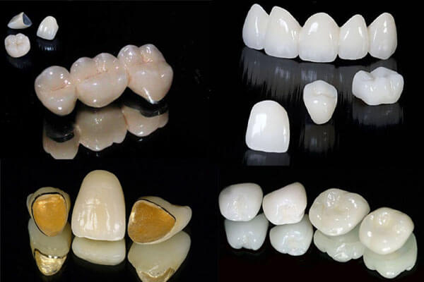 Hướng dẫn cách chăm sóc răng sứ cho người mới bọc tốt nhất Tuổi thọ của từng loại răng sứ như thế nào?