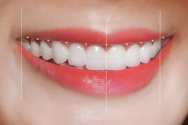 Hàm răng đẹp như thế nào? 10 Yếu tố quyết định răng đẹp? Cung hàm răng đẹp đạt tiêu chuẩn