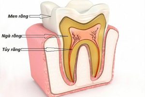 Quy trình lấy tuỷ răng như thế nào? Mất khoảng bao lâu?