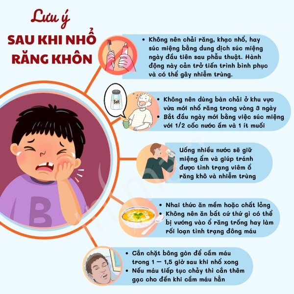 Những việc cần làm để răng khôn mau lành lại. Những việc cần làm để răng khôn mau lành lại.