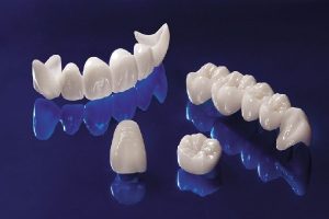 Giới thiệu về răng sứ zirconia