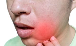 Làm gì khi bị sưng nướu răng và nổi hạch?