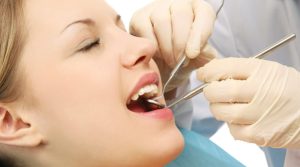 Thăm khám răng miệng sau khi trám định kỳ