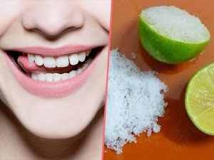 Cách làm trắng răng bằng chanh tại nhà hiệu quả