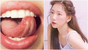 Hướng dẫn đặt lưỡi đúng cách khi tập Mewing hiệu quả nhanh