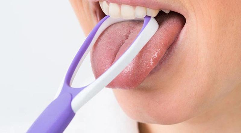 Vệ sinh răng miệng mỗi ngày giúp phòng ngừa lưỡi trắng kèm hôi miệng Vệ sinh răng miệng mỗi ngày giúp phòng ngừa lưỡi trắng kèm hôi miệng