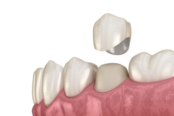 Răng cửa thưa gây nên tình trạng khó nói
