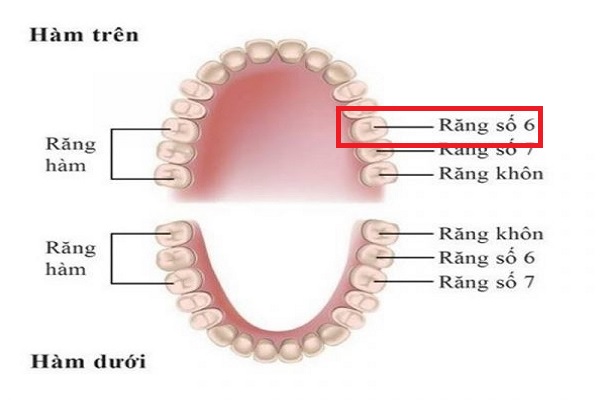 Răng số 6 hàm trên là gì? Có nên nhổ hay không? Cách chăm sóc răng số 6 đúng cách
