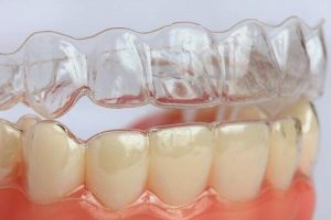 Tướng Răng Thưa Là Người Như Thế Nào? Tốt Hay Xấu