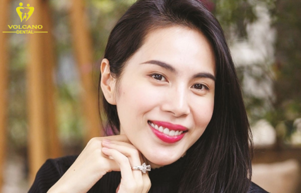 Nụ cười duyên của ca sĩ Thủy Tiên luôn rạng rỡ và cuốn hút