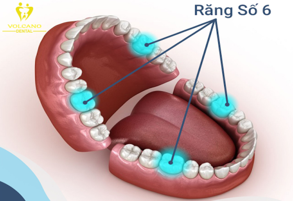 Răng số 6 có thay không? Răng số 6 là một trong những răng hàm cuối cùng và nằm xa nhất phía sau trong hàm Răng số 6 có thay không? Răng số 6 là một trong những răng hàm cuối cùng và nằm xa nhất phía sau trong hàm