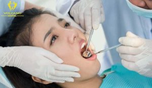 Nhổ răng khôn bao lâu thì lành? Mẹo phục hồi nhanh