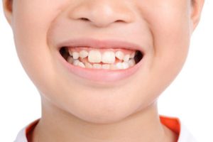 Răng hàm đóng vai trò trọng nhất trong bộ răng của trẻ em