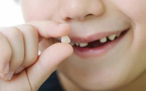 14 Tuổi nhổ răng có mọc lại không? Giải đáp từ chuyên gia