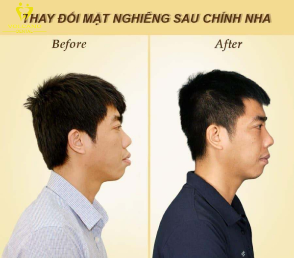 Nha khoa Việt Pháp Nha khoa Việt Pháp