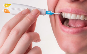 Có nên dùng bàn chải kẽ? Hướng dẫn sử dụng bàn chải kẽ đúng cách