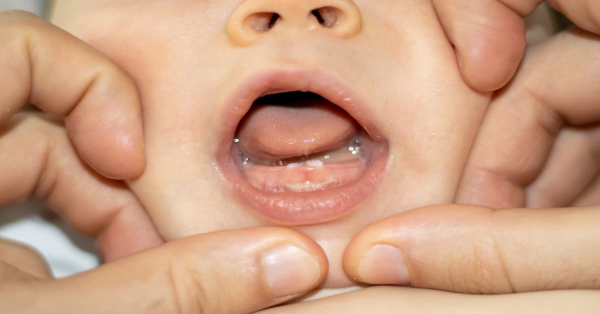 Khi trẻ bắt đầu mọc răng, có thể thấy rằng họ tăng tiết dịch nước bọt hơn so với bình thường Khi trẻ bắt đầu mọc răng, có thể thấy rằng họ tăng tiết dịch nước bọt hơn so với bình thường