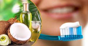 Cách làm trắng răng bằng dầu dừa