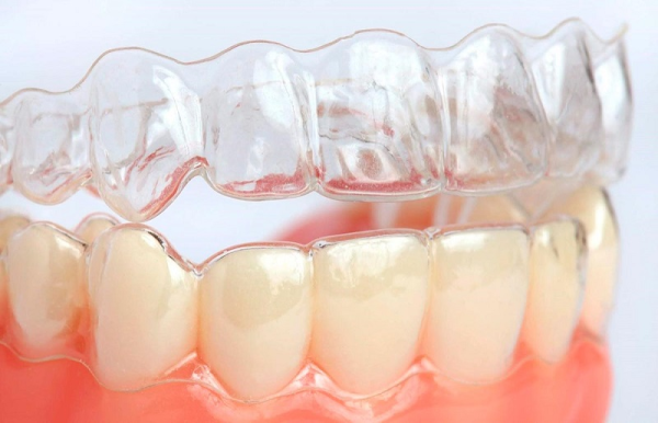 Niềng răng trong suốt là một phương pháp điều trị nha khoa tiên tiến Niềng răng trong suốt có hiệu quả không? Niềng răng trong suốt là phương pháp điều trị nha khoa tiên tiến