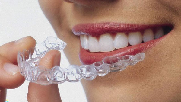 Trong khi niềng răng trong suốt mang lại nhiều ưu điểm, nhưng cũng không thiếu nhược điểm cần xem xét Trong khi niềng răng trong suốt mang lại nhiều ưu điểm, nhưng cũng không thiếu nhược điểm cần xem xét