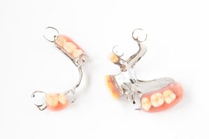 Hàm khung tháo lắp là gì? Ưu nhược điểm hàm khung tháo lắp