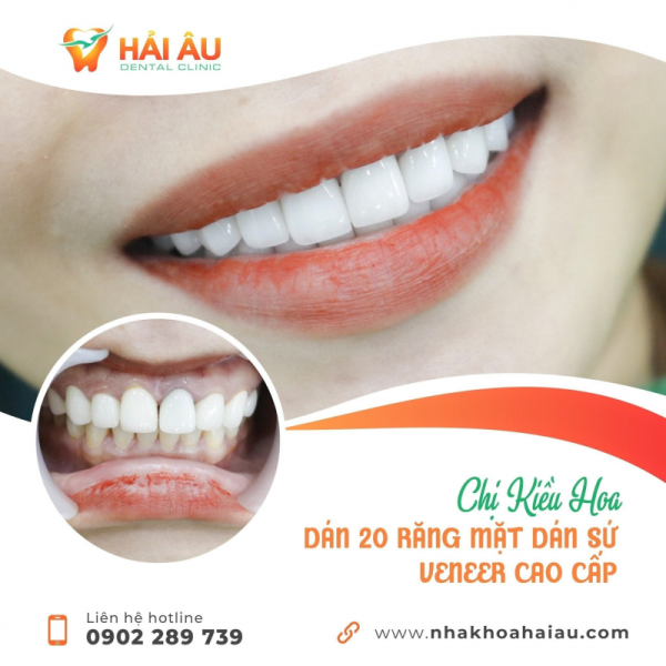 Nha khoa Hải Âu Nha khoa Hải Âu