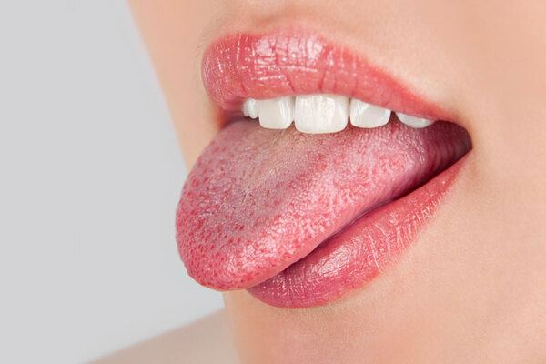 Tình trạng viêm gai lưỡi nổi lốm đốm mụn trắng Tình trạng viêm gai lưỡi nổi lốm đốm mụn trắng