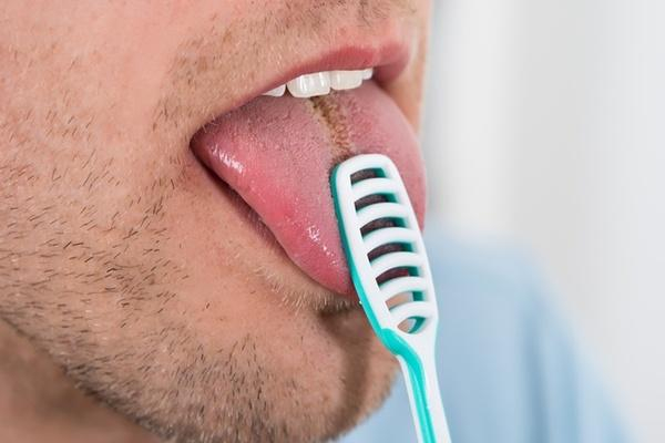 Một số phương pháp hạn chế viêm gai lưỡi hiệu quả Một số phương pháp hạn chế viêm gai lưỡi hiệu quả