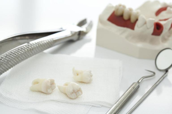 Những phương pháp nhổ răng hiệu quả Những phương pháp nhổ răng hiệu quả