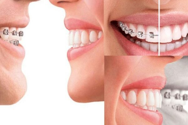 Một số phương pháp điều trị Một số phương pháp điều trị